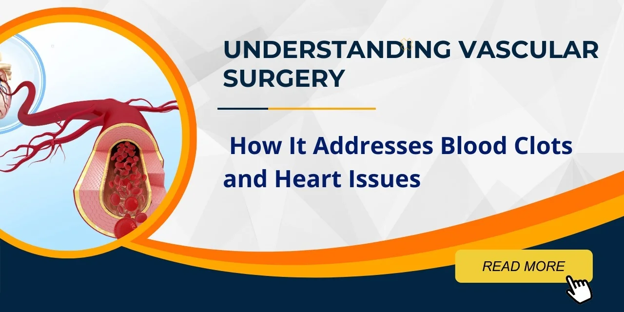 Understanding Vascular Surgery: How It Addresses Blood Clots and Heart Issues